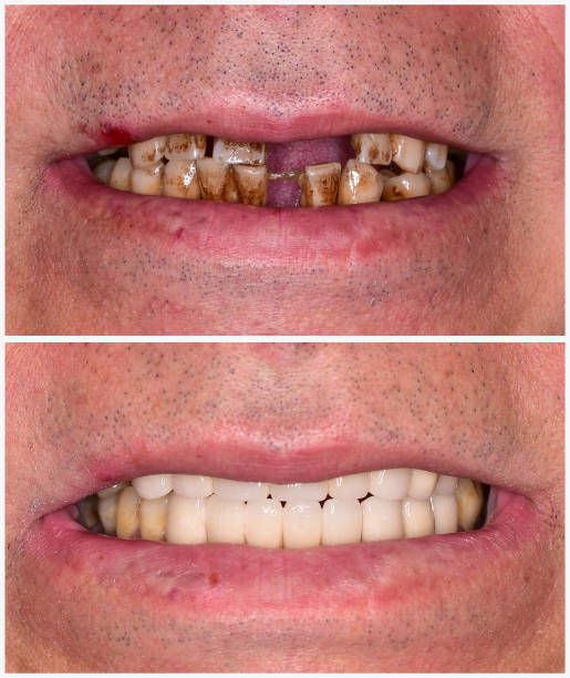 general dentistry  Los Angeles, CA 