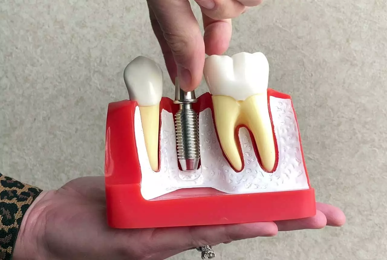 general dentistry  Los Angeles, CA 