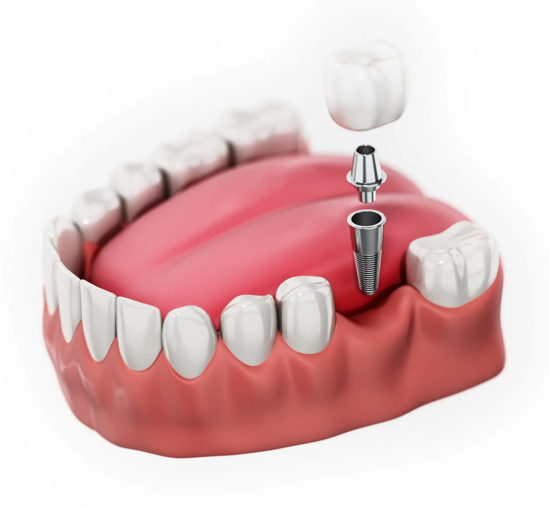 general dentistry  Los Angeles, CA 