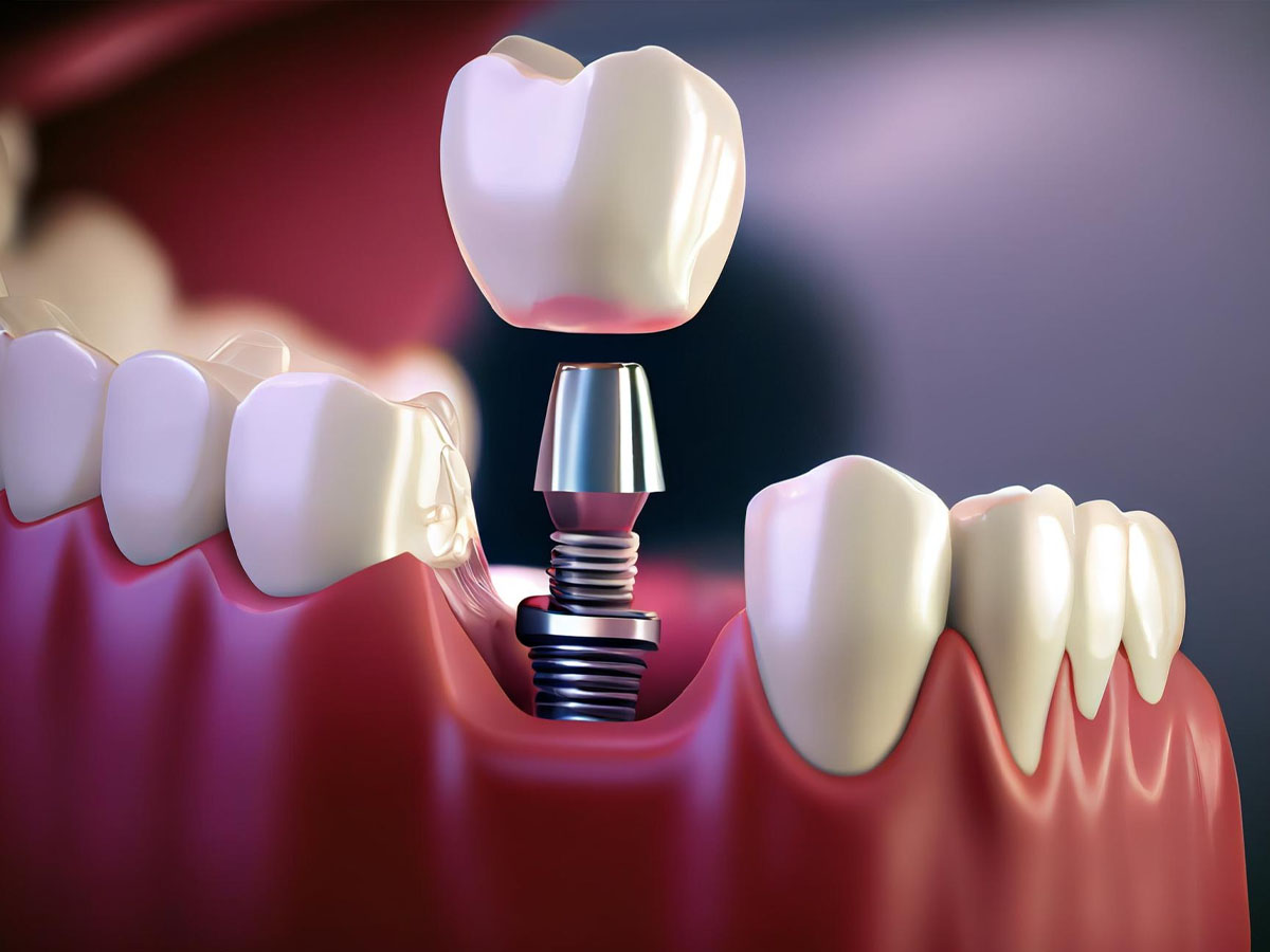 general dentistry  Los Angeles, CA 