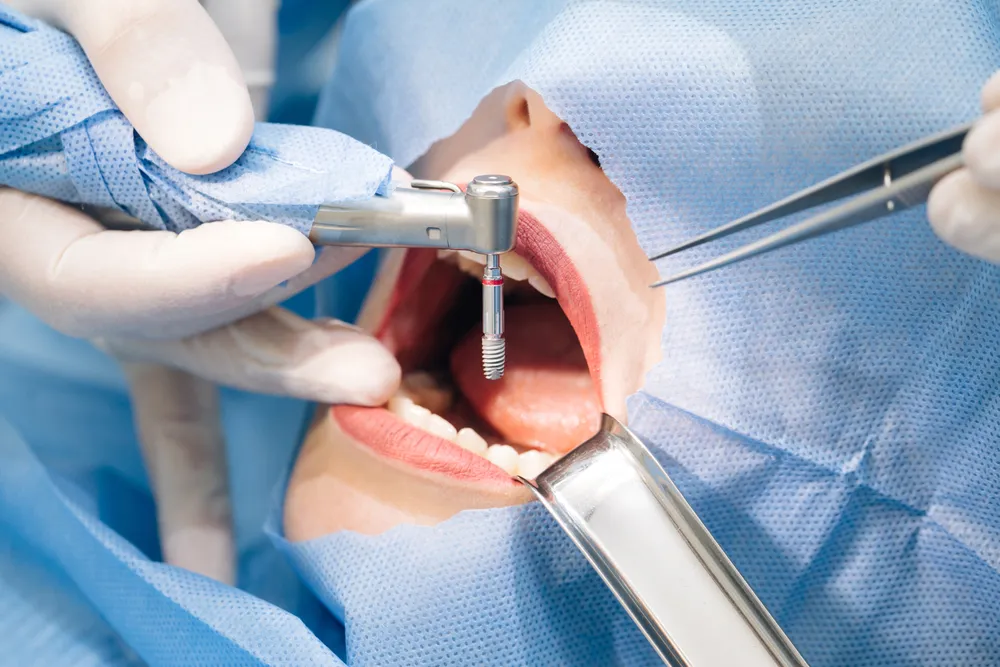 general dentistry  Los Angeles, CA 