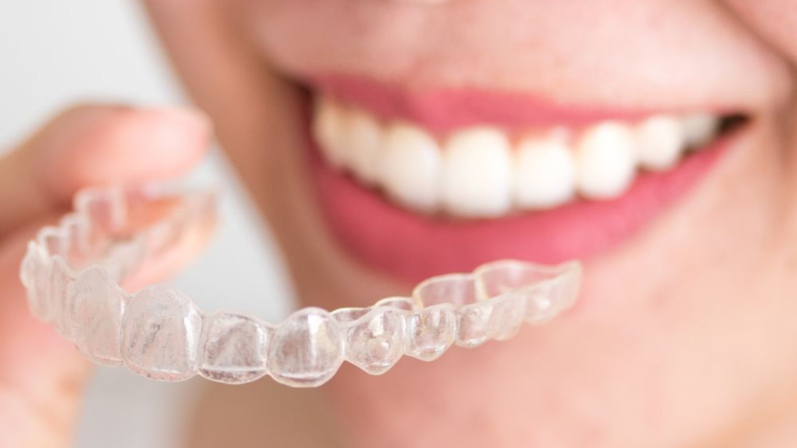 Invisalign