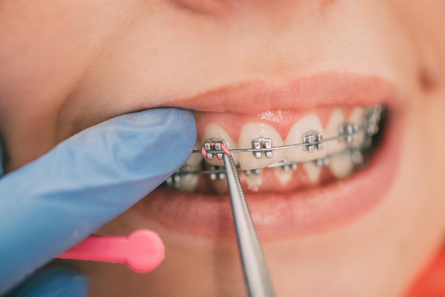 general dentistry Los Angeles, CA