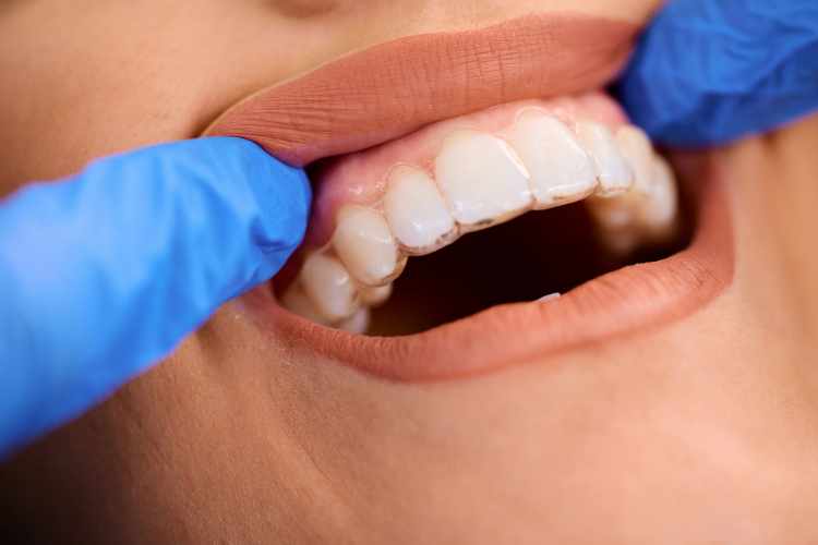 general dentistry  Los Angeles, CA 