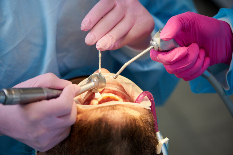 scaling and polishing procedure