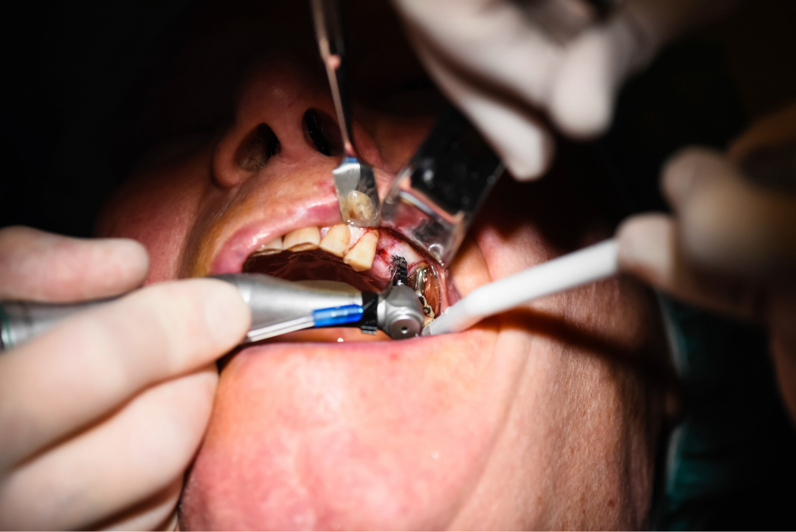 general dentistry  Los Angeles, CA 