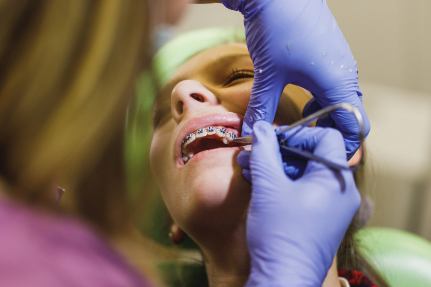 general dentistry  Los Angeles, CA 