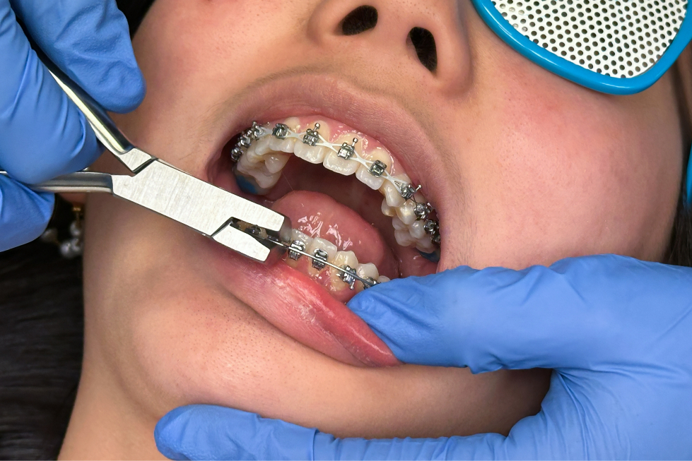 general dentistry Los Angeles, CA