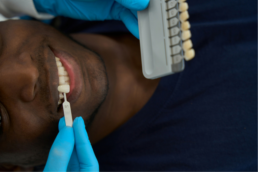 general dentistry  Los Angeles, CA 