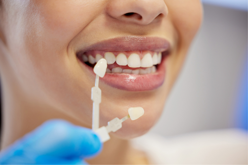 general dentistry  Los Angeles, CA 