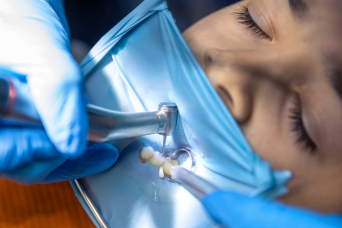 general dentistry  Los Angeles, CA 