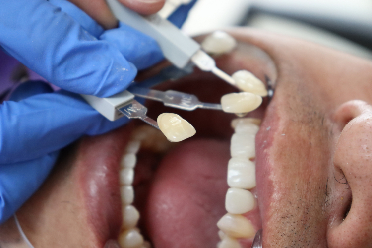 general dentistry  Los Angeles, CA 