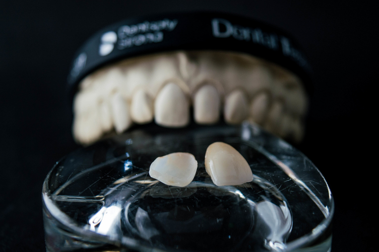 general dentistry  Los Angeles, CA 