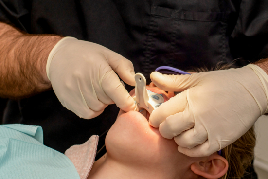 general dentistry  Los Angeles, CA 