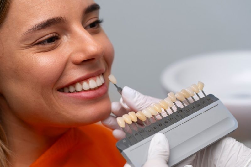 Porcelain Veneers